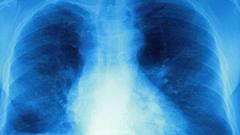 access-to-cystic-fibrosis-drugs-approved-in-england