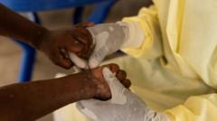 first-case-of-more-dangerous-mpox-found-outside-africa