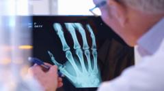 ai-to-help-doctors-spot-broken-bones-on-x-rays