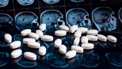 nhs-will-not-fund-new-drug-to-slow-alzheimer’s